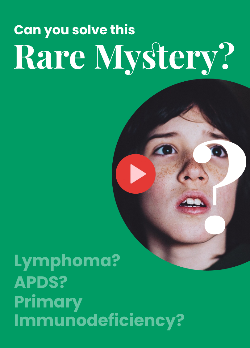 Rare Mysteries